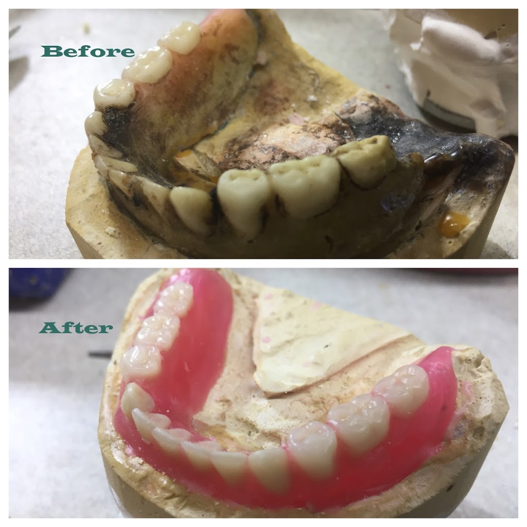 Dans Denture Clinic | 172 Manning Crossing NW, Edmonton, AB T5A 5A1, Canada | Phone: (780) 244-3200