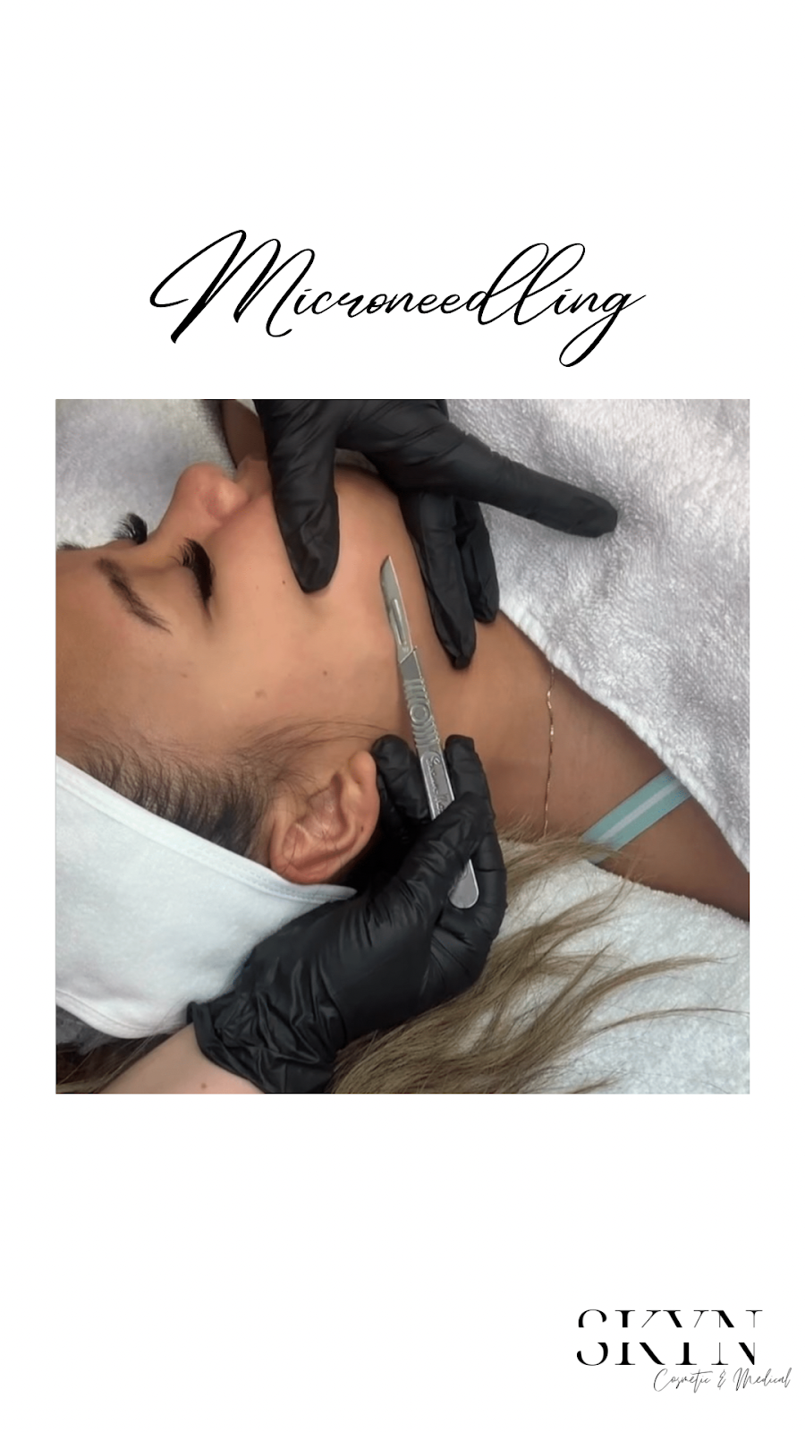 SKYN Cosmetic & Medical Studio | 5920 Turney Dr, Mississauga, ON L5M 2R8, Canada | Phone: (905) 812-0513