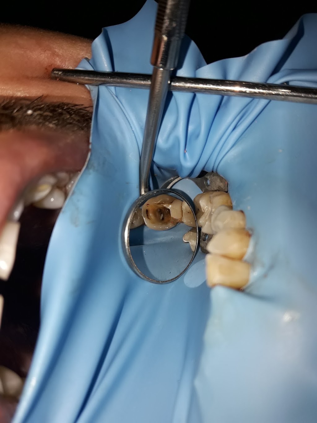 Elegance Dental Centre | 138 Bedford Hwy, Halifax, NS B3M 0A3, Canada | Phone: (902) 453-9999