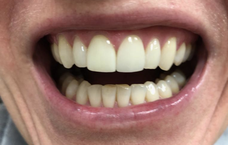 Innovative Dental Laboratories | 1706 Danforth Ave, Toronto, ON M4C 1H8, Canada | Phone: (416) 463-3138