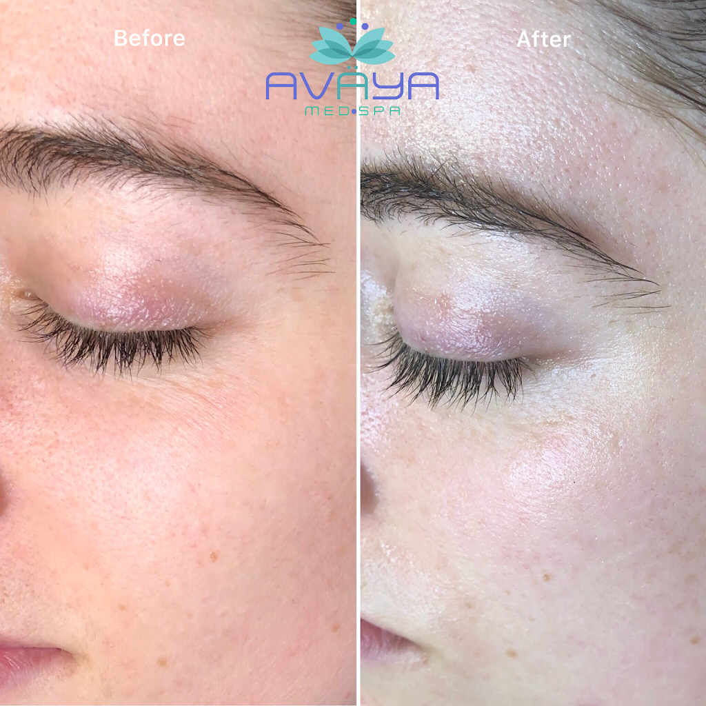 AVÄYA Skin | 875 Bank St suite 3, Ottawa, ON K1S 3W4, Canada | Phone: (647) 963-0550