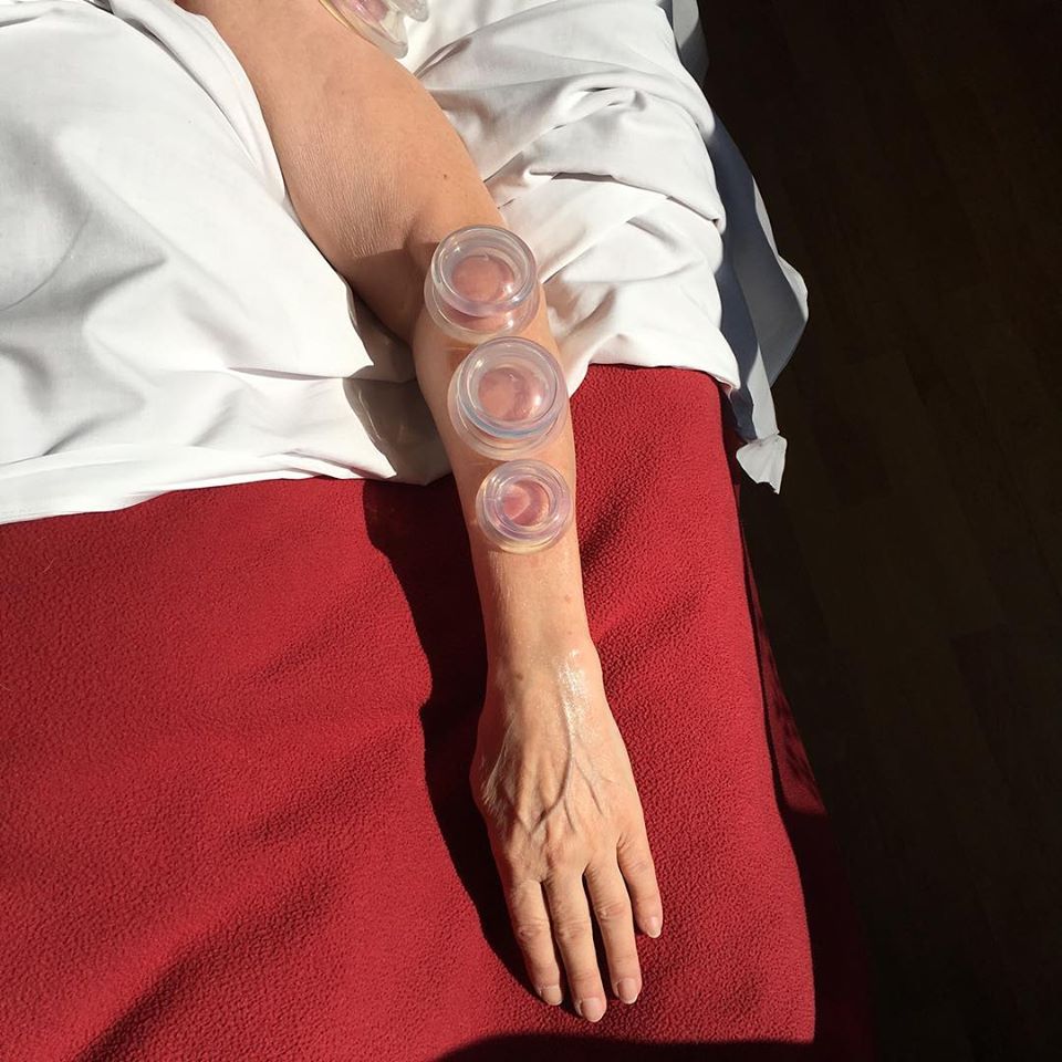 Guelph Acupuncture | 1 Southampton St, Guelph, ON N1H 5N3, Canada | Phone: (519) 826-7762