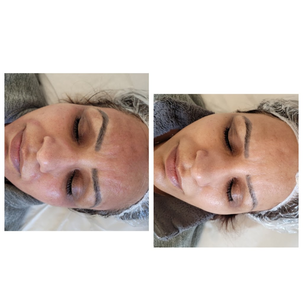 Derma Glow MD | 522 Milsom Wynd, Delta, BC V4M 2T4, Canada | Phone: (604) 218-9441