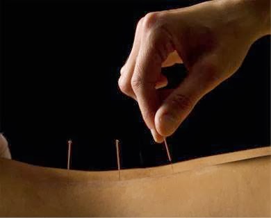 Clinique dacupuncture Johanne Marcotte | 231 1e Rang, Sainte-Mélanie, QC J0K 3A0, Canada | Phone: (450) 755-4400
