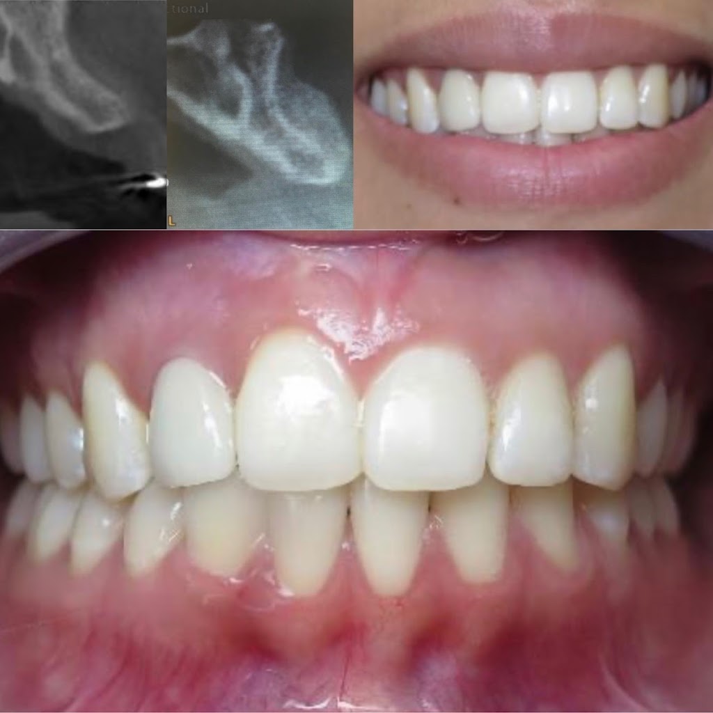 Luna Dental | 4600 Crowchild Trail NW, Calgary, AB T3A 2L6, Canada | Phone: (403) 286-2525