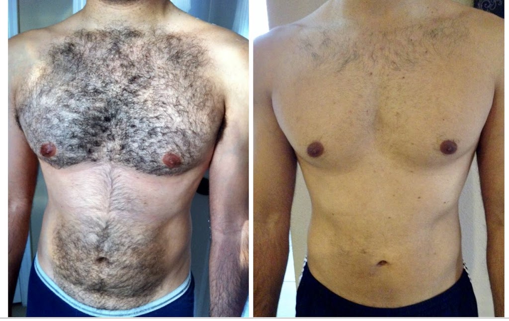ABLC - Advanced Body & Laser Center | 165 Windham Ln, Grand Island, NY 14072, USA | Phone: (716) 628-7649