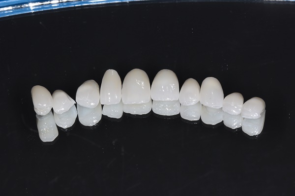 Newtonbrook Dental | 139 Finch Ave W, North York, ON M2N 2J1, Canada | Phone: (416) 223-2453