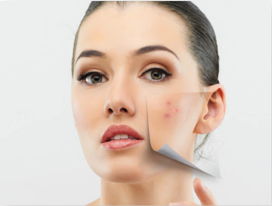 Velvet Beauty Bar Inc | Exhibition Cres, Brampton, ON L7A 4B9, Canada | Phone: (416) 315-8197