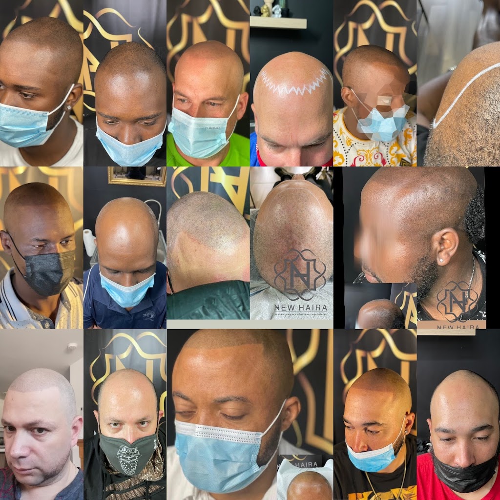 New Haira Micro Pigmentation Capillaire | 9590 Boul Henri-Bourassa E #102, Montreal, QC H1E 1P8, Canada | Phone: (450) 822-8575