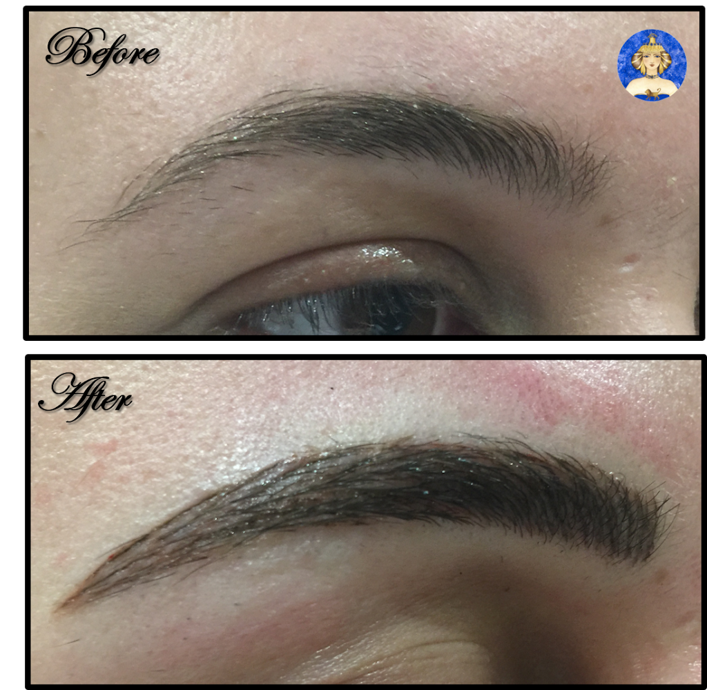 Innana Laser Clinic | 6 Worthington Pl, Bedford, NS B4A 0C5, Canada | Phone: (902) 835-6871