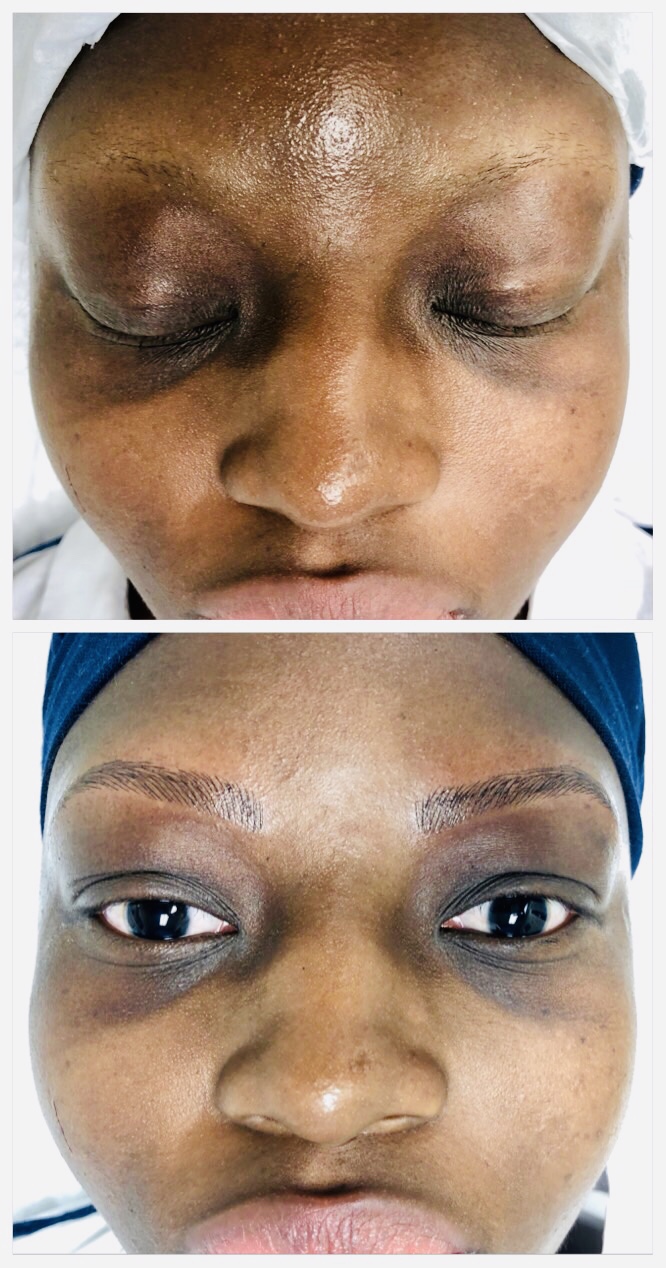 iBrow & Laser Clinic | 1595 Bedford Highway Suite 228, Sunnyside Mall, Bedford, NS B4A 3Y4, Canada | Phone: (902) 406-9526