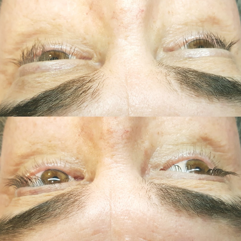Angel Faces Esthetics | 156 Ibbotson Close, Red Deer, AB T4R 0C5, Canada | Phone: (403) 304-6457