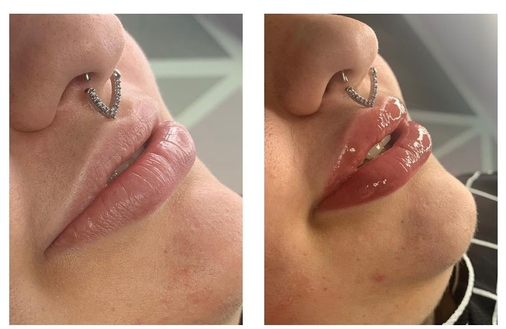 Freckled Cosmetic Tattoo | 4113 33 St, Red Deer, AB T4N 0N1, Canada | Phone: (403) 352-8238