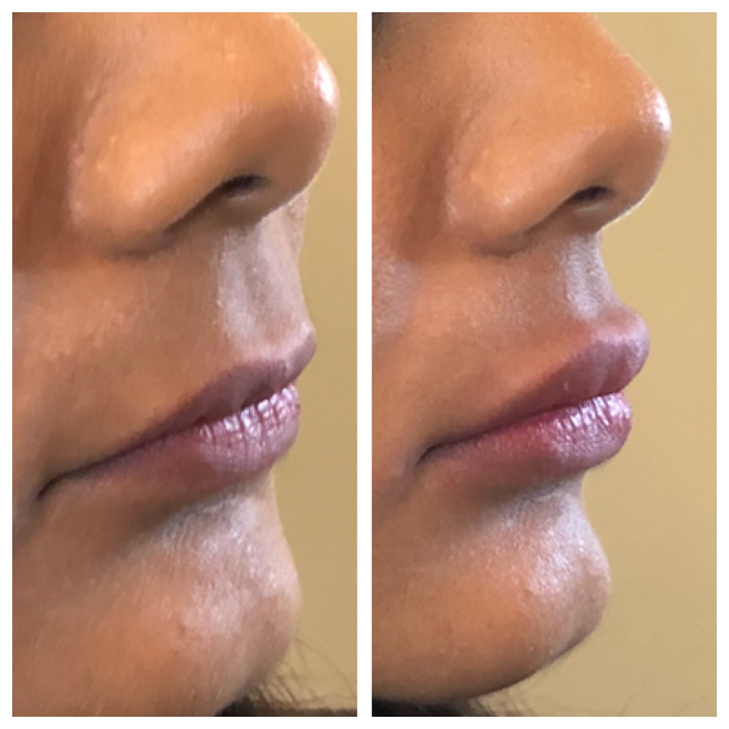 Ageless Medical Cosmetic Clinic | 1100 Dundas St W unit 1, Mississauga, ON L5C 4E7, Canada | Phone: (647) 951-5392