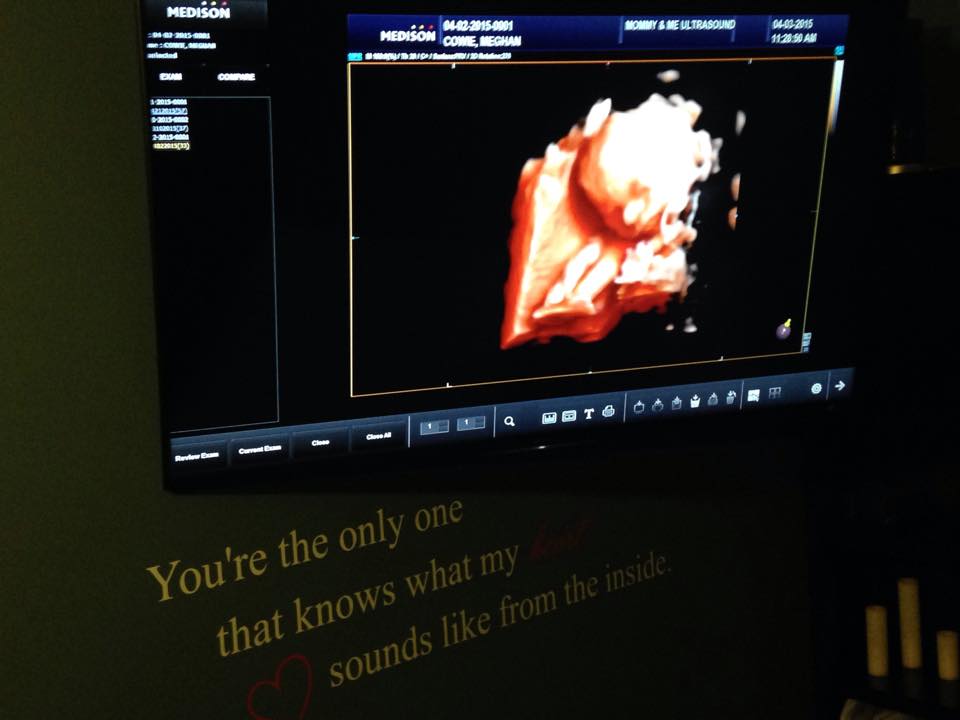 Mommy & Me 3D/4D/HD Ultrasounds | 43 Dalhousie Ave, Kentville, NS B4N 5E5, Canada | Phone: (902) 692-1813