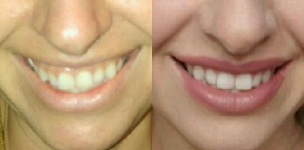 Alexs Beauty Bar | 34 Kidd Street, Bradford, ON L3Z 0V5, Canada | Phone: (416) 274-6805