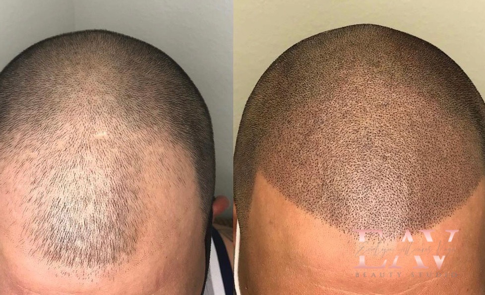 EAV Cosmetic Tattoo Studio | 7601 Bathurst St, Vaughan, ON L4J 4H5, Canada | Phone: (647) 898-7105