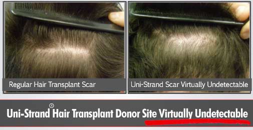 Sure Hair International | 55 Wyndham St N Suite T7, Guelph, ON N1H 7T8, Canada | Phone: (416) 747-7873