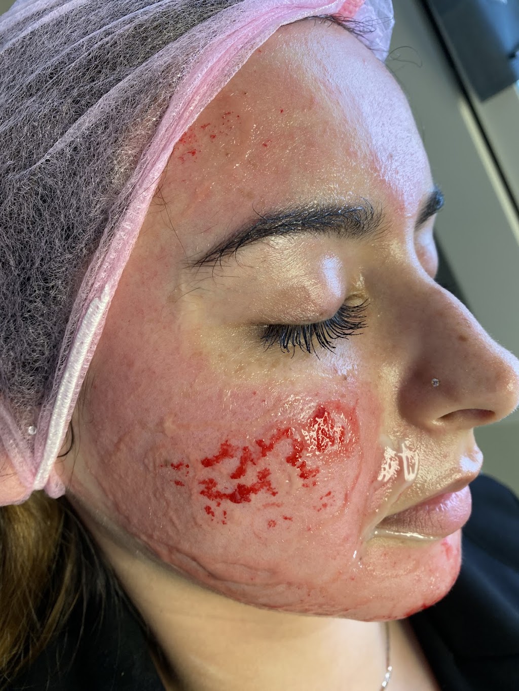 Clinique my face | 5551 Bd Laurier Suite 202, Terrebonne, QC J7M 1T7, Canada | Phone: (514) 980-6228