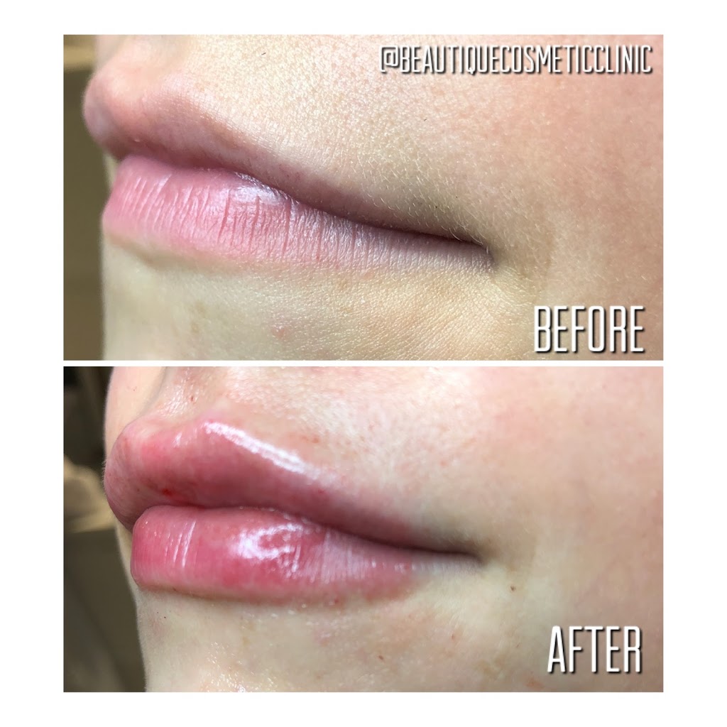 Fresh Cosmetic Clinic | 132 Atlantic Ave, Toronto, ON M6K 1X9, Canada | Phone: (416) 732-2219