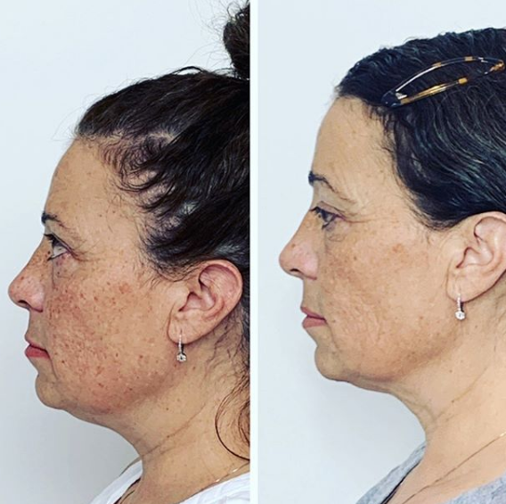 Jada Skin and Health Institute | 3030 Pandosy St #213, Kelowna, BC V1Y 0C4, Canada | Phone: (778) 581-7675