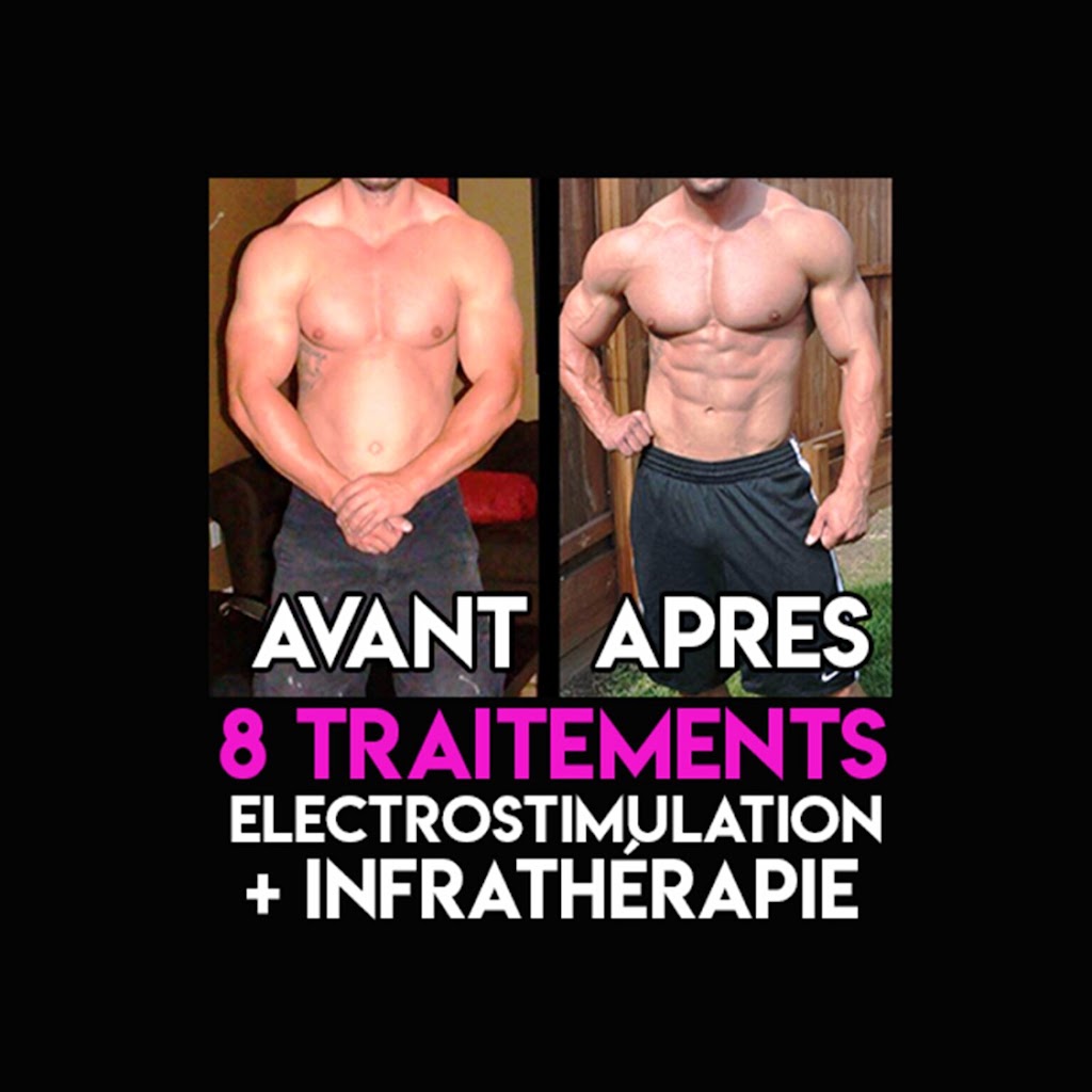 Electrostimulation rive-sud | 87-d Rue St Pierre, Saint-Constant, QC J5A 1G7, Canada | Phone: (514) 730-8423