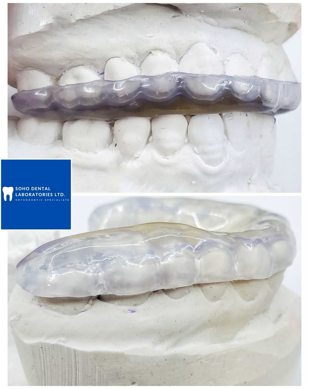 Soho Dental Laboratories Ltd | 4008 Deane Pl, North Vancouver, BC V7G 2P3, Canada | Phone: (604) 722-4855