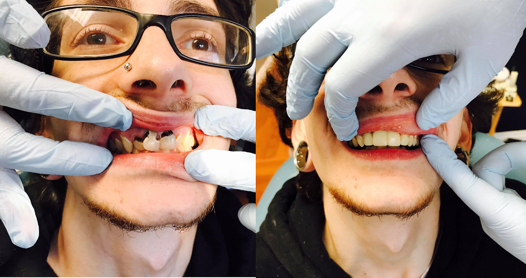 Bellwether Dental | 12 Bellwether Way #112, Bellingham, WA 98225, USA | Phone: (360) 366-8026