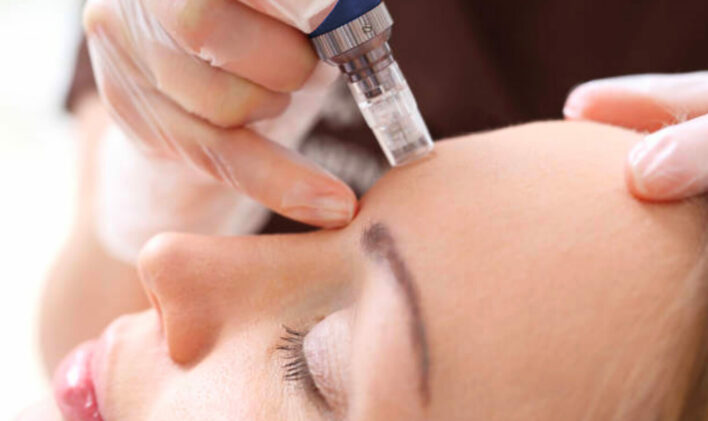W.art Tatouage & Soins Dermo Esthétique | Rte Louis-Cyr, Saint-Jean-de-Matha, QC J0K 2S0, Canada | Phone: (450) 916-0587