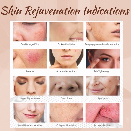 Green Lotus Laser + Skin | 5761 135 St, Surrey, BC V3X 2T9, Canada | Phone: (778) 242-0165