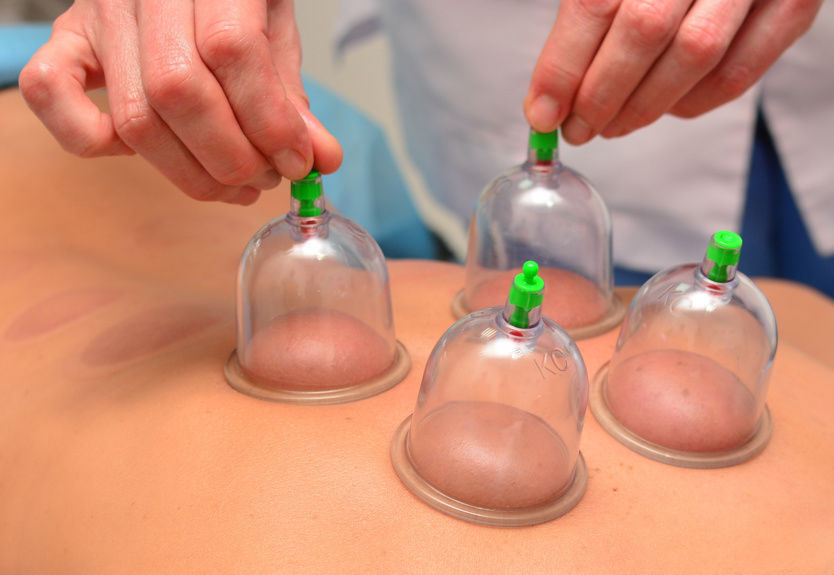 HijamahWorks Osteopathic & Wet Cupping Specialists | 4299 Village Centre Court - Lower Level (Room #306, Mississauga, ON L4V 1Y5, Canada | Phone: (844) 445-2624