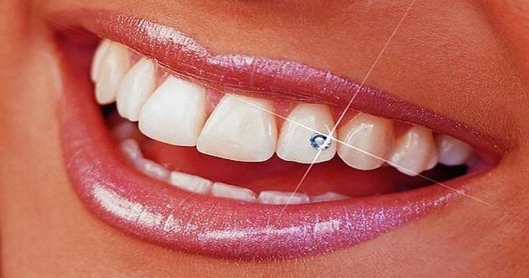 Dental Care007 | 19 Moran Rd, Scarborough, ON M1S 2H8, Canada | Phone: (647) 559-3970