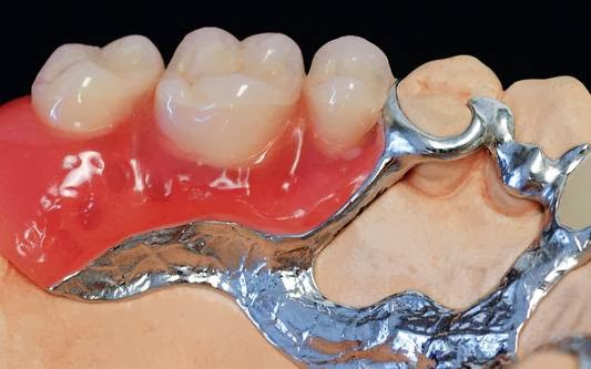 Champagne Dental Center | 7659a Rue Centrale, LaSalle, QC H8P 1L4, Canada | Phone: (514) 364-4658