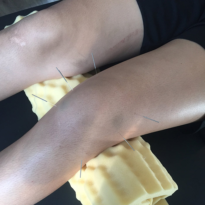 IN HOME PHYSIOTHERAPY | 112 Dagenham St, Ottawa, ON K2S 2N5, Canada | Phone: (613) 296-8502