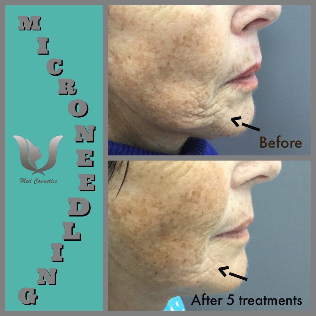 Med Cosmetics Clinic | 7700 Bathurst St #200, Thornhill, ON L4J 7Y3, Canada | Phone: (905) 597-5111