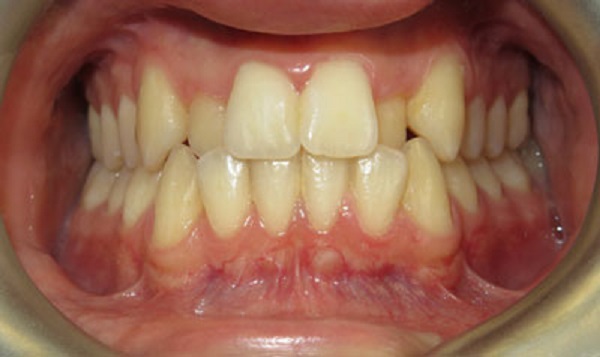 Charlton Dentistry | 230 James St S, Hamilton, ON L8P 3B3, Canada | Phone: (289) 389-9199