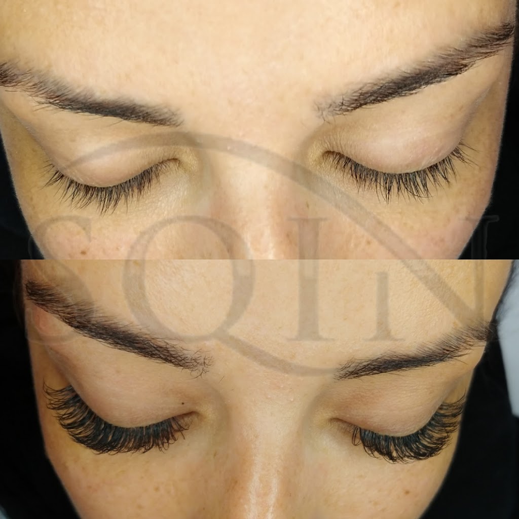 SQIN Med | 6150 Valley Way Unit 105, Niagara Falls, ON L2E 1X9, Canada | Phone: (905) 358-7746