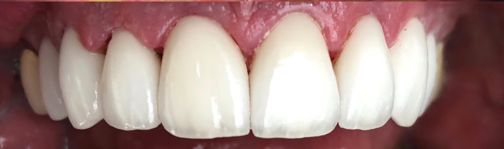 Corydon Dental Centre | 1425 Corydon Ave #201, Winnipeg, MB R3N 2C7, Canada | Phone: (204) 487-1744