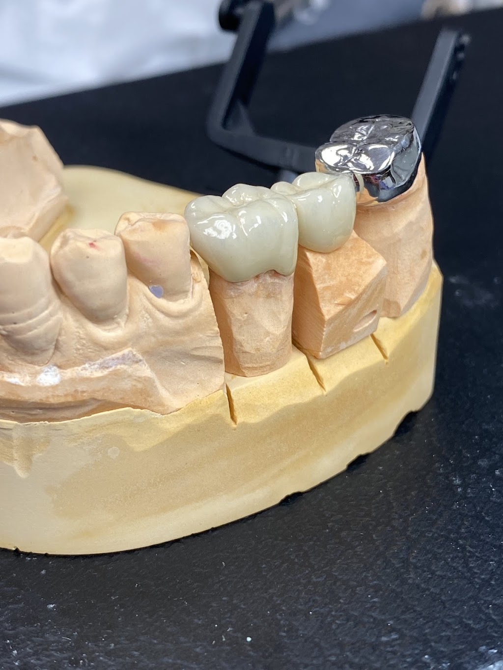 Labworks Dental Services | 10160 Ainsworth Crescent, Richmond, BC V7A 3V4, Canada | Phone: (604) 916-1875