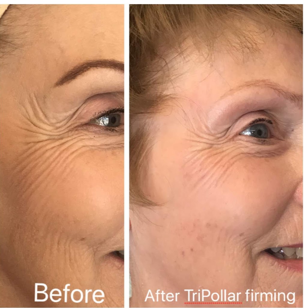 Noor Aesthetics | 2004 Kurelo Dr, Oshawa, ON L1G 8L7, Canada | Phone: (647) 299-1486
