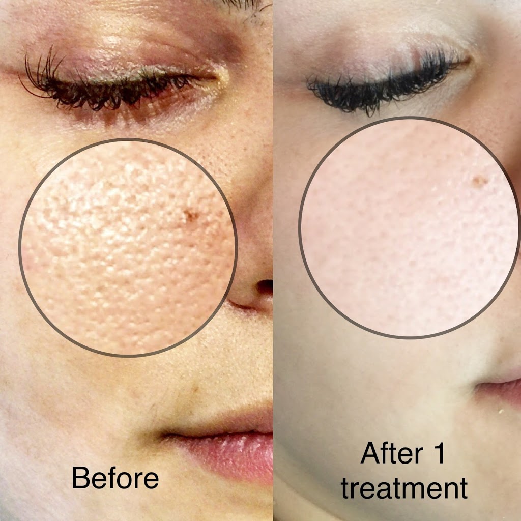 Browlicious Beauty Spa | 830 Rowntree Dairy Rd unit 6, Woodbridge, ON L4L 5V2, Canada | Phone: (647) 848-1111