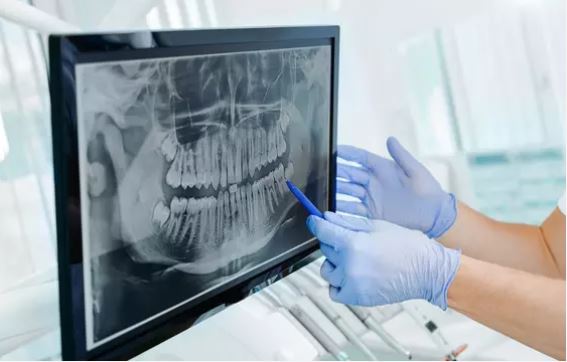 London Dental House by Dr. Joseph | 529 Queens Ave, London, ON N6B 1Y3, Canada | Phone: (519) 672-5600