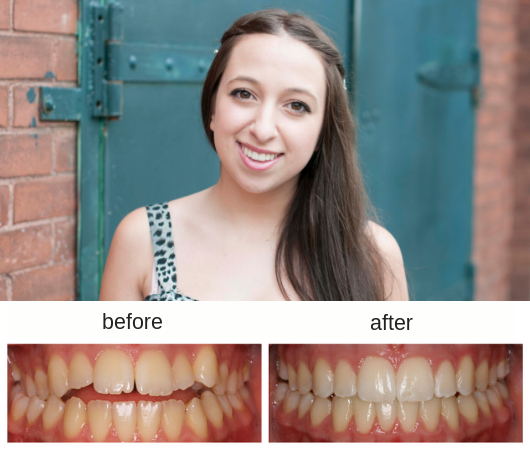 Hometown Orthodontics | 228 Lakeshore Rd W Suite 3, Mississauga, ON L5H 1G6, Canada | Phone: (905) 278-6513