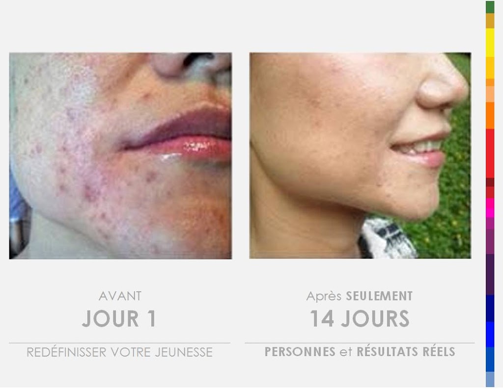 evolution beaute | 1172 Rue Saint Louis, Saint-Jean-Chrysostome, QC G6Z 2L2, Canada | Phone: (418) 956-9488