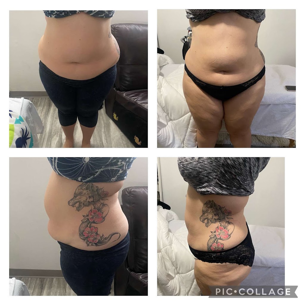 Precise Body Lab | 31125 Kingfisher Dr, Abbotsford, BC V2T 5K4, Canada | Phone: (778) 345-5345