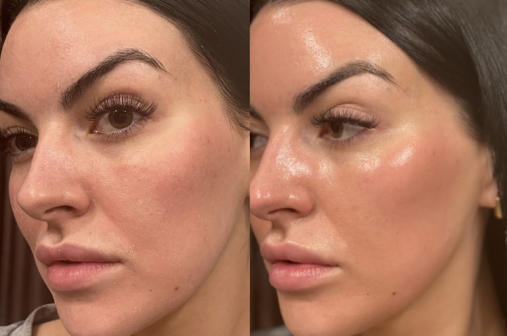 Carewell Laser Esthetics | 6490 Old Banff Coach Rd SW, Calgary, AB T3H 5R8, Canada | Phone: (604) 312-3034