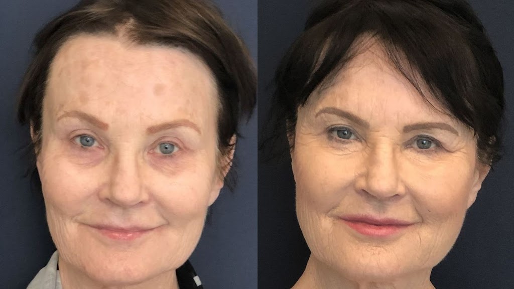 White Rock Skin and Laser Clinic | 15850 26 Ave #101, Surrey, BC V3Z 2N6, Canada | Phone: (778) 545-1925