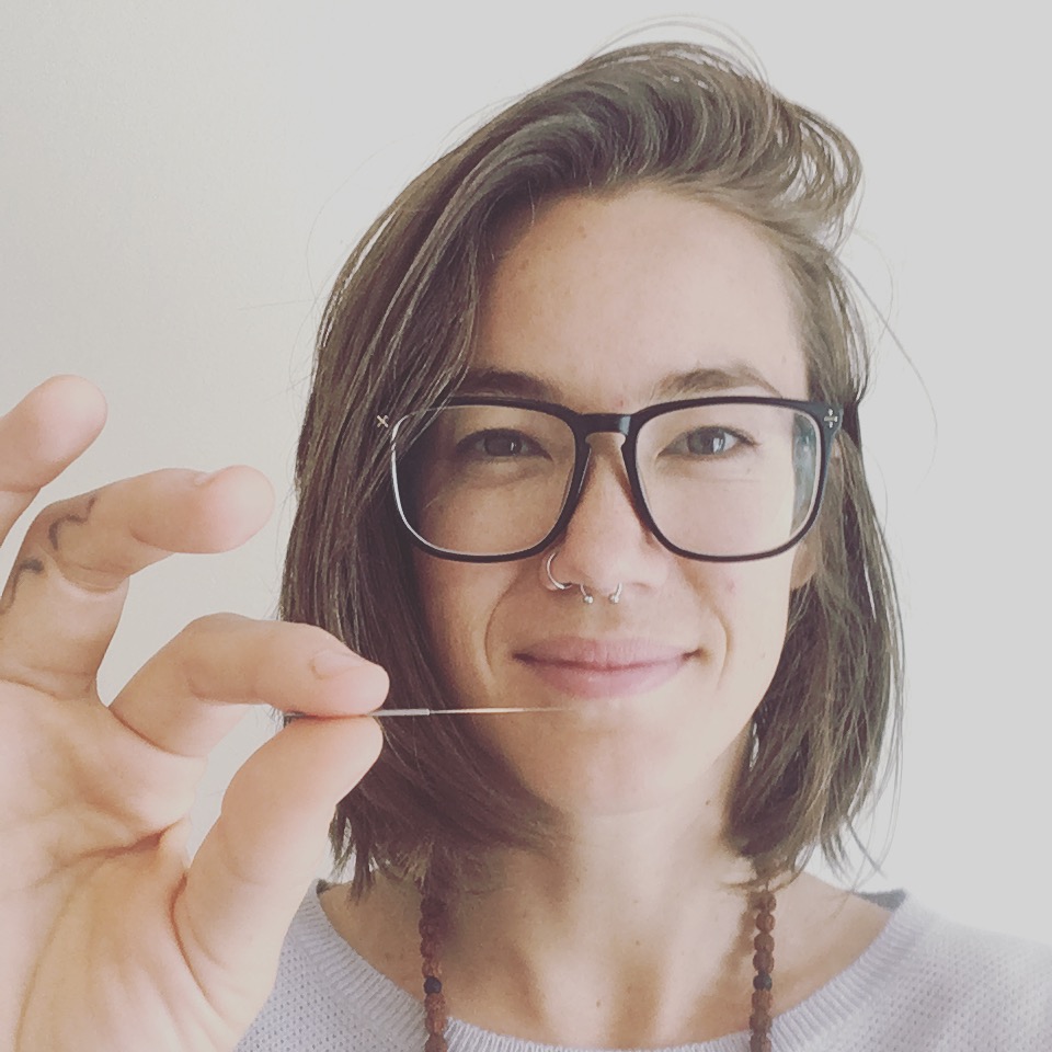 Love and Acupuncture | 2755 Dunsmuir Ave, Cumberland, BC V0R 1S0, Canada | Phone: (250) 703-3772