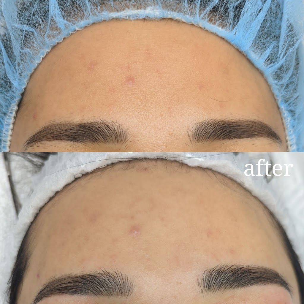 Rosewood_Aesthetics_Clinic | 3670 63 Ave NE, Calgary, AB T3J 0G7, Canada | Phone: (403) 798-7447