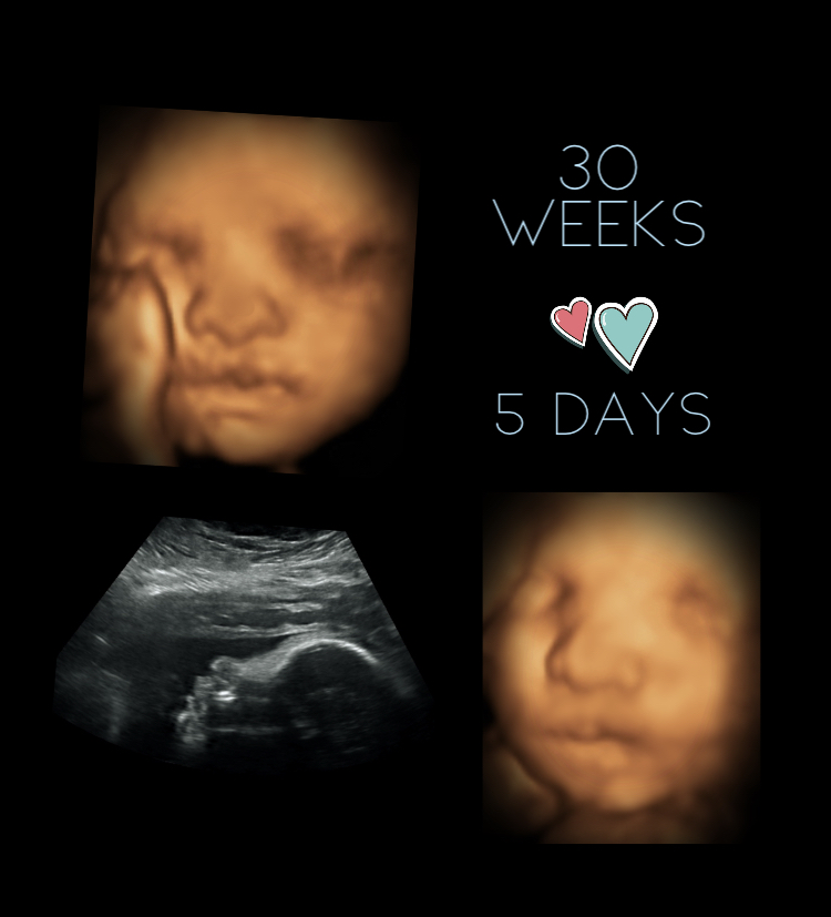 Prenatal Peek 3D4D Ultrasound - 98 Golden Boy Ln, Winnipeg, MB R3W 0L9 ...